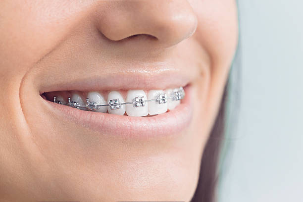 Best Traditional Braces  in Park City, TN